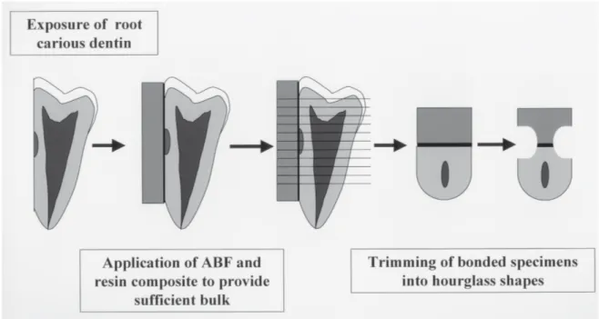 FIGURE 7 -Schematic diagram showing the methodology used in our study to measure µTBS of ABF to root carious dentin