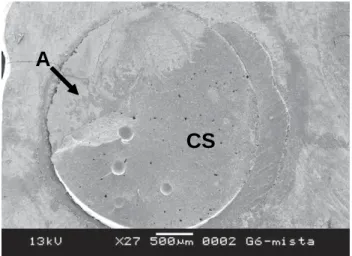 FIGURE 1- SEM photomicrograph illustrating a mixed failure for Group 1 (A – adhesive; CS – cohesive in sealant)