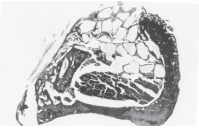 FIGURE 1 - Biogran (BG) 7 days. Spaces taken up by glass particles of varying sizes (A); thin bone trabeculae, some of them with lamellar aspect and marrow tissue