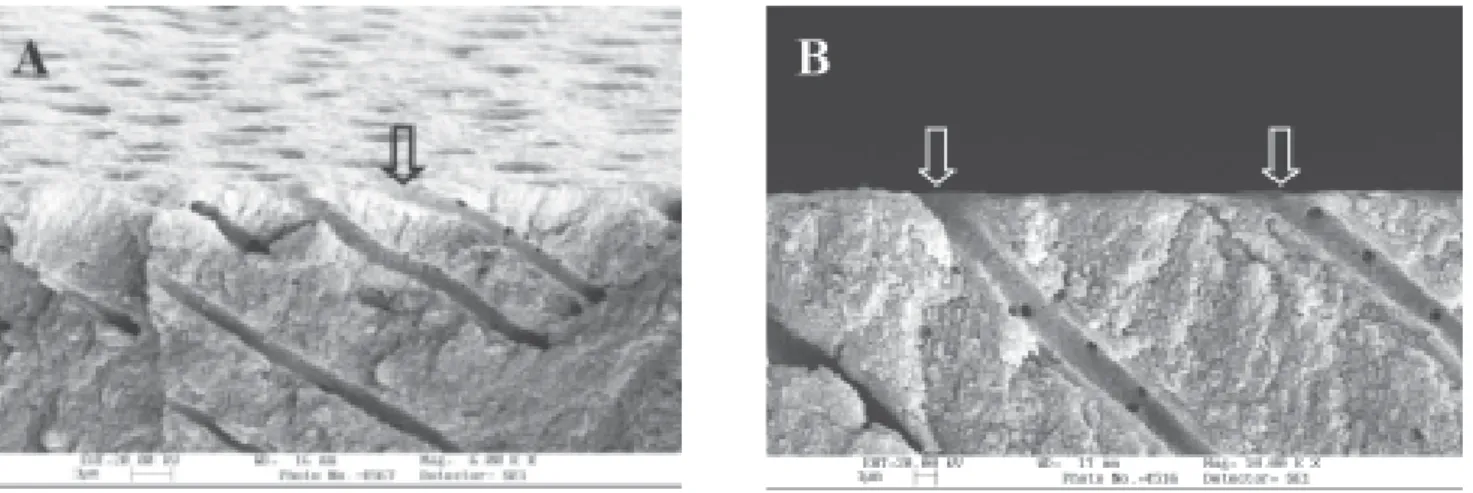 Table 1 describes the composition of tested desensitizing agents. Specimens were fixed in Karnovisk solution for 1 hour and fractured with a sharp blade placed perpendicular to the buccal surface