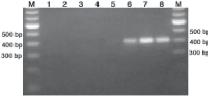 FIGURE 3- Schematic diagram of RT-PCR showing that RNA isolated from cells or tissue is used as substrate in reverse transcription for synthesis of cDNA that will serve as template for amplification by PCR.