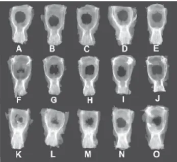 FIGURE 4.- Radiographic images of 1-month (A-E), 3-month (F-J) and 6-month (L-P) experimental groups
