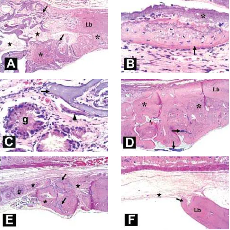 FIGURE 6.- Histological images: (A-C) 1-month experimental group; A) intertrabecular porosities filled with connective tissue (stars) and newly formed bone tissue (asterisks) in the lesion border (Lb) and associated with the trabecular surface of matrix (a