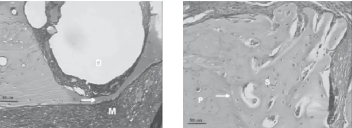 FIGURE 1-  Photomicrographs of the surgically-created (unfilled) defects in rat tibia
