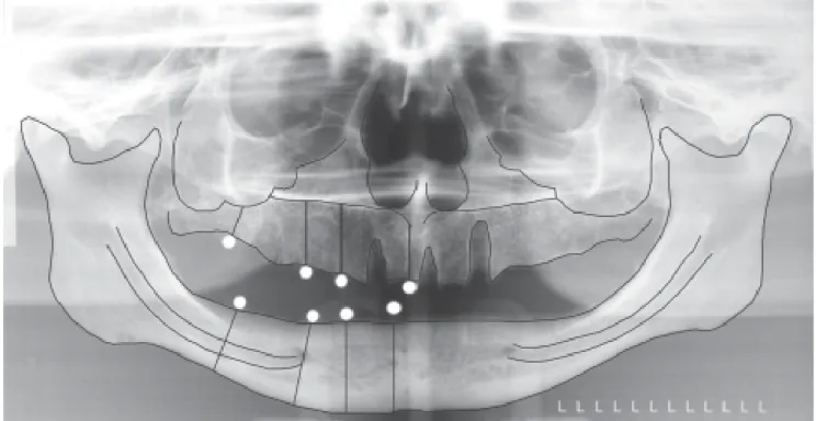 FIGURE 1 - Manual tracing in panoramic radiography