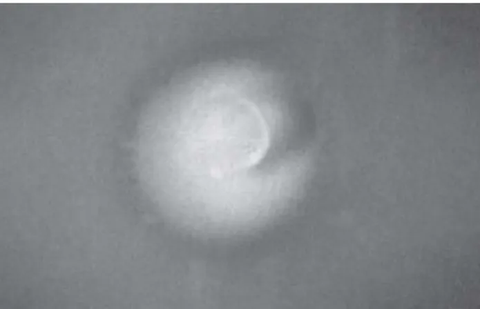 FIGURE 2- Mild genotoxicity of chlorhexidine gel containing zinc oxide against strain PQ35 in the SOS chromotest