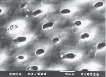 FIGURE 1- SEM of a control group specimen showing a uniform smear layer (score 6). (3500x magnification; bar