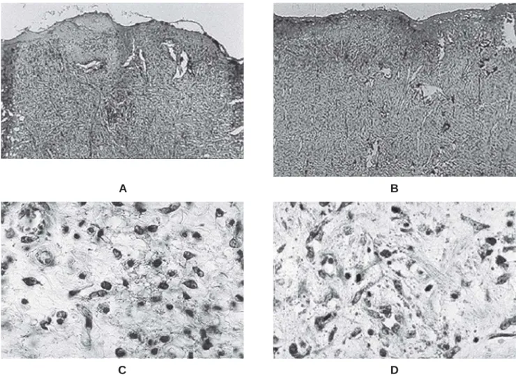 FIGURE 1- A- In the IG, on the 7 th  day, note that granulation tissue showed poor cellular organization; B- CaIG, on the 7 th  day, functional capillaries were shown to be present in higher number and degree of differentiation and the granulation tissue s