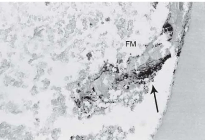 FIGURE 6 - Sealer 26. Note great resorption of the apical third of the root and only little resorption of the filling material (arrow)