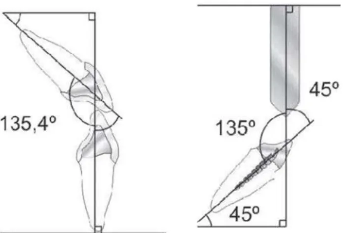 FIGURE 3- Device used for fixation and positioning of specimens subjected to fracture resistance tests in a universal testing machine