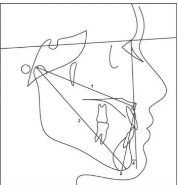 FIGURE 2- Cephalometric measurements used (in mm):