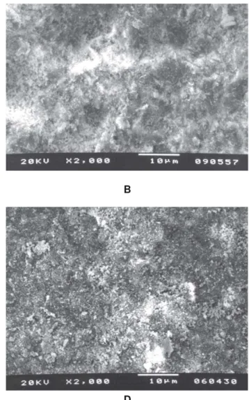 FIGURE 4-  Treated ceramic surface of In-Ceram Zirconia (ZR):  A  – Al 2 O 3  particles;  B  – SiO x  particles (x2000)