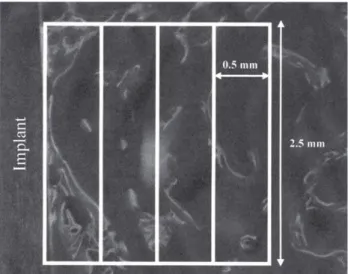 FIGURE 1- Representation of a micrograph (at 40x original magnification) subdivision into 0.5 mm base by 2.5 mm height rectangles for quantification of tetracycline labeled bone area fraction
