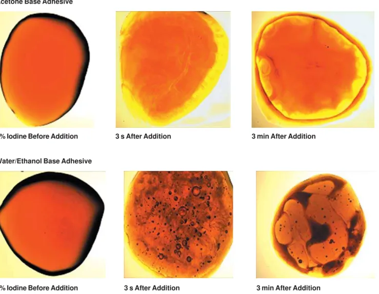 FIGURE 1- This sequence shows the stereomicroscopic images from one drop of the I 2 DDS mixed with one drop of acetone- acetone-based adhesive and water- and/or ethanol-acetone-based adhesive (3 seconds and 3 minutes after addition)