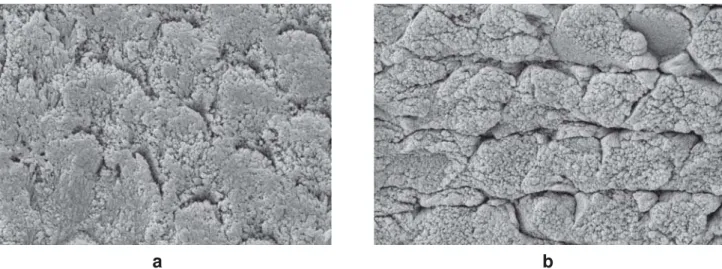 FIGURE 2- SEMs of ground (2a) and intact (2b) enamel surfaces etched with 35% phosphoric acid