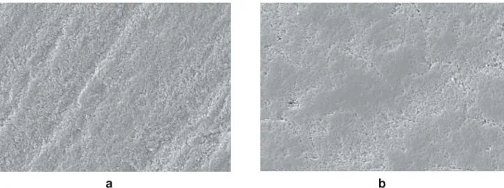 FIGURE 5- SEMs of ground (5a) and intact (5b) enamel surfaces treated with Clearfil Protect Bond self-etching primer.