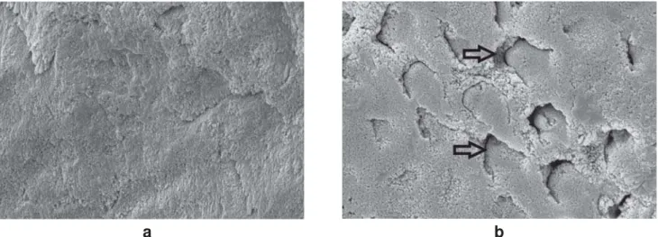 FIGURE 8- SEMs of ground (8a) and intact (8b) enamel surfaces treated with Optibond Bond Solo Plus self-etching primer.