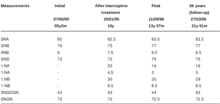 TABLE 1-  Cephalometric measures of the patient at the beginning, end of treatment and follow-up phase