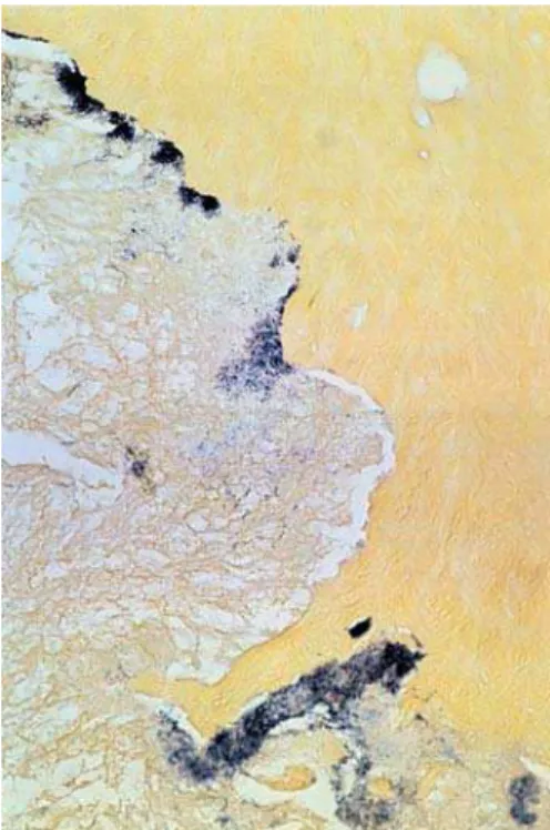 FIGURE 7- Microorganisms forming biofilms in the apical and periapical region, Brown &amp; Brenn - 125X