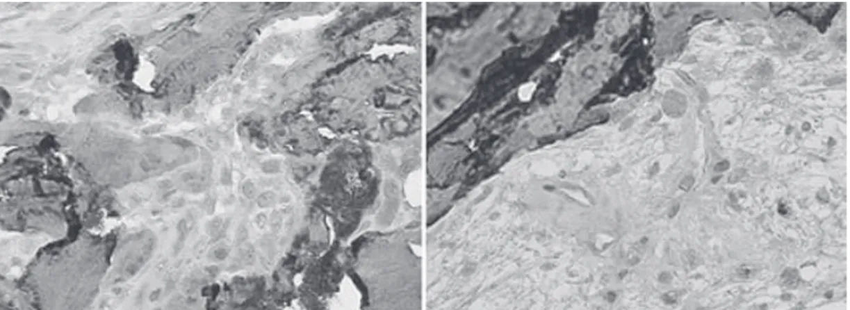 Figure  9.  Microphotograph  of  decalcified  sections,  DAB  immunohistochemistry  staining  for  osteocalcin, respectively