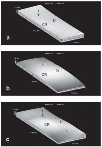 Figure 4 shows representative photomicrographs of specimens. In (c), great gap formation at the internal angles in a 3-mm-deep cavity can be seen