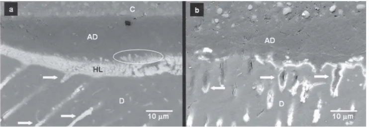 FIGURE 1- Backscattered SEM images of the resin-dentin interface bonded with SBMP (2500x)