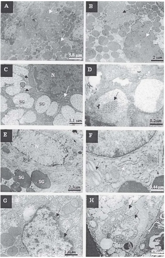 FIGURE 1-  Transmission electron microscopy of the control group and irradiated submandibular salivary gland tissue 4 h after gamma ray irradiation