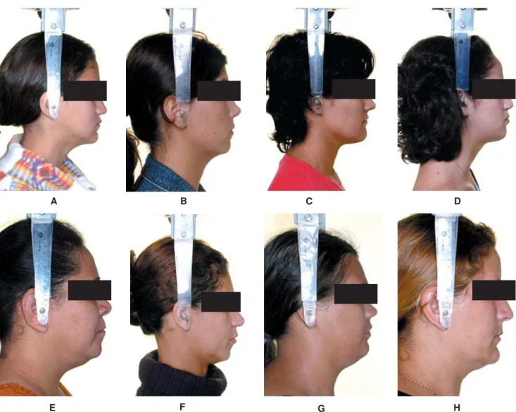 TABLE 4- Statistics of evaluation of the facial pattern