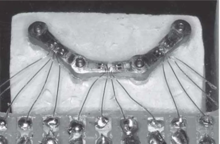 FIGURE 2- Device for analyzing the strain gauges of the test specimens