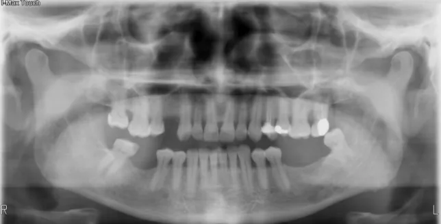 Figura 9: Radiografia panorâmica. 