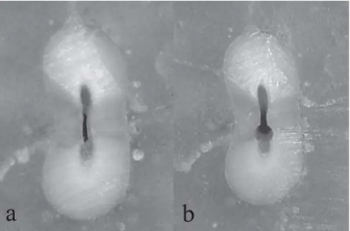 FIGURE 3-  Apical third before (a) and after (b) preparation with RaCe system (Score 2)