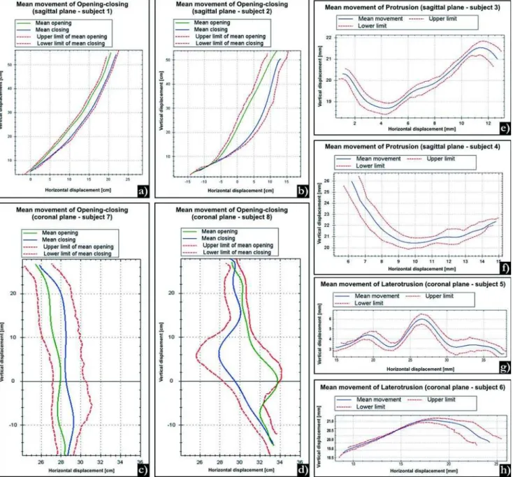 FIGURE 4- Graphs showing the evaluation of the functional movements of the mandible from 8 subjects