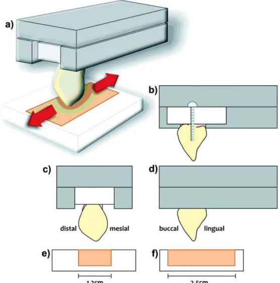 FIGURE 1-  a) The canine tooth specimen mounted on the upper stainless steel holder of the apparatus (movable part) and the antagonist plate mounted on the fixed bottom part