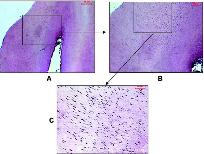 FIGURE 2- When cementum is present over the dentin layer no contamination was observed in dentinal tubules (original magnification x 10)
