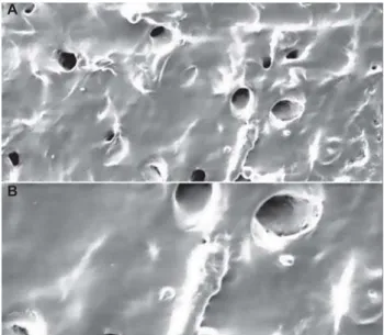FIGURE 2A and B- Adherence of Candida albicans and bacteria on a soft denture liner coated with saliva A – Note that bacteria and fungi are united
