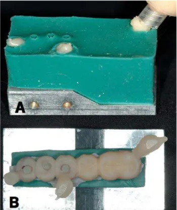 FIGURE 2- Lateral view of 3 prosthetic components attached to the metallic base at the bottom of lower portion of the silicone matrix