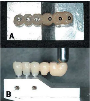 FIGURE 6- Specimen fixed on metallic base (upper view) (A) where the circles on the occlusal surface show possible load application points; Lateral view (B) where a metallic pin is applying force at the cantilever most distal point