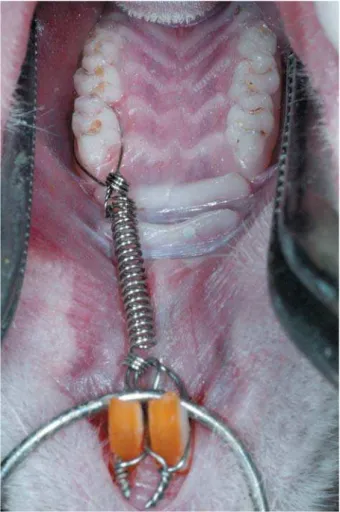 Figure 1- Orthodontic appliance used to achieve mesial             maxillary incisors, delivering a force of 75 g 