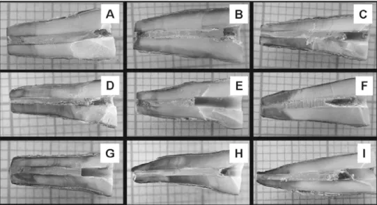 FIGURE 1- Photographs of teeth in groups A, B, C, D, E, F, G, H and I to be evaluated using computer-assisted morphometry (x4)