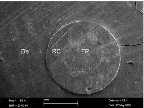 FIGURE 1- Non-relined fiber post specimen after the push-out test. Note that debonding occurred between the resin cement and the dentin