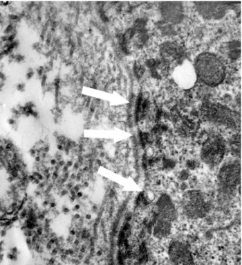 FIGURE 9-  TEM micrograph showing collagen fibers organized parallel bundles under the basement membrane (x16700)