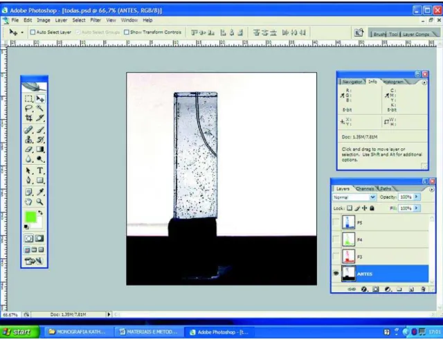 FIGURE 1- Simulated canal before preparation with gray tone inversion in Adobe Photoshop CS2 program