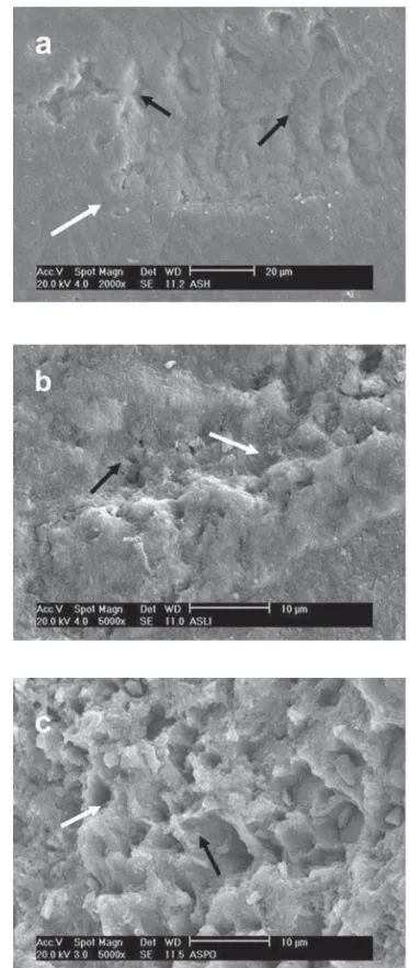 FIGURE 5- SEM micrograph of different enamel treated- treated-groups following treatment with AdheSe self-etching primer.
