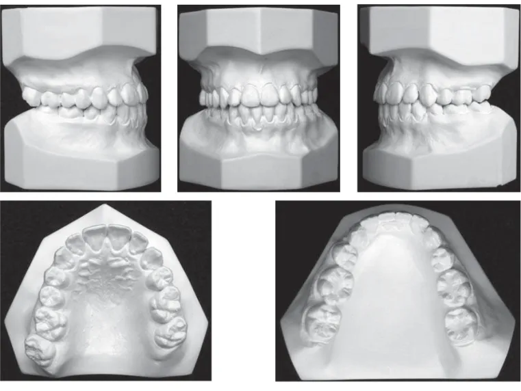 FIGURE 7-  Posttreatment study models