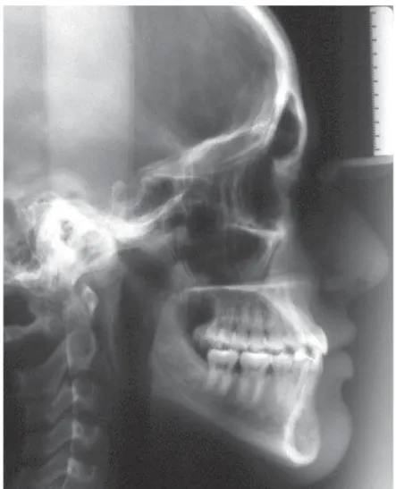 FIGURE 9-  Posttreatment panoramic radiograph