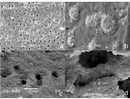 FIGURE 2-  Scanning electron microscopy of (a) Root dentinal surface covered by  E. faecalis  biofilm (X5,000)