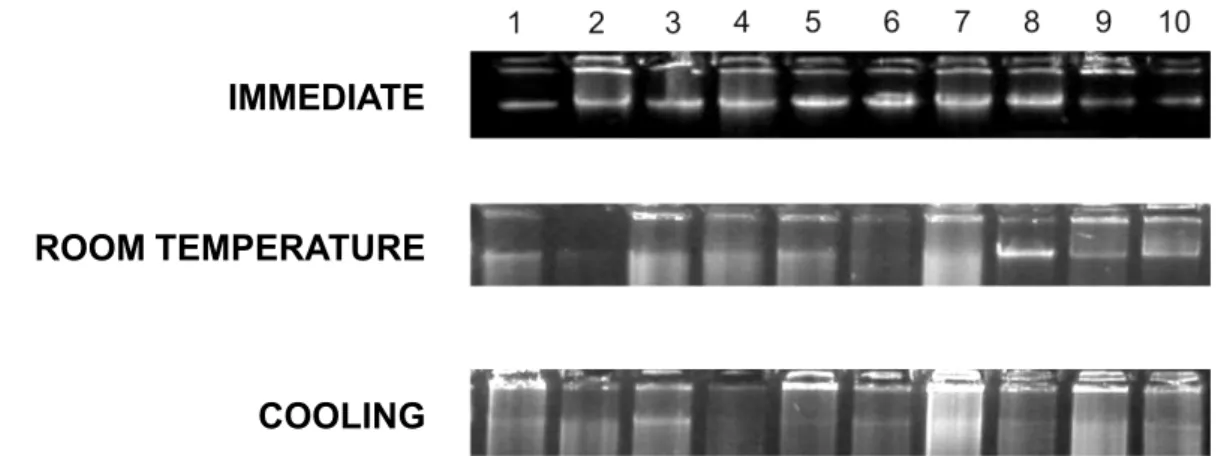 FIGURE 1-  Quality of DNA evaluated by agarose gel electrophoresis. When the samples were processed immediately after collection, the DNA bands were strong and clear