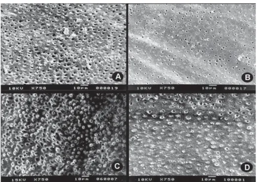 Figure 2- Scanning electron microscopy micrographs representative of the four groups: A – Control (no drug); B – Ca(OH) 2 ;  C – Propolis paste A70D; D – Propolis paste D70D