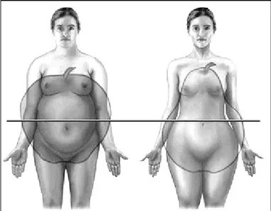Figura 1. Figura demonstrando os casos de obesidade andróide e ginóide.