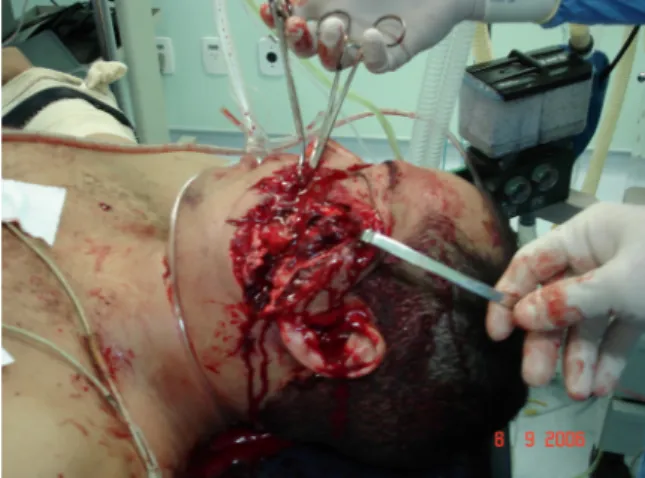 Figura 1. Aspecto clínico do paciente vítima de ferimento por projétil de arma de fogo.